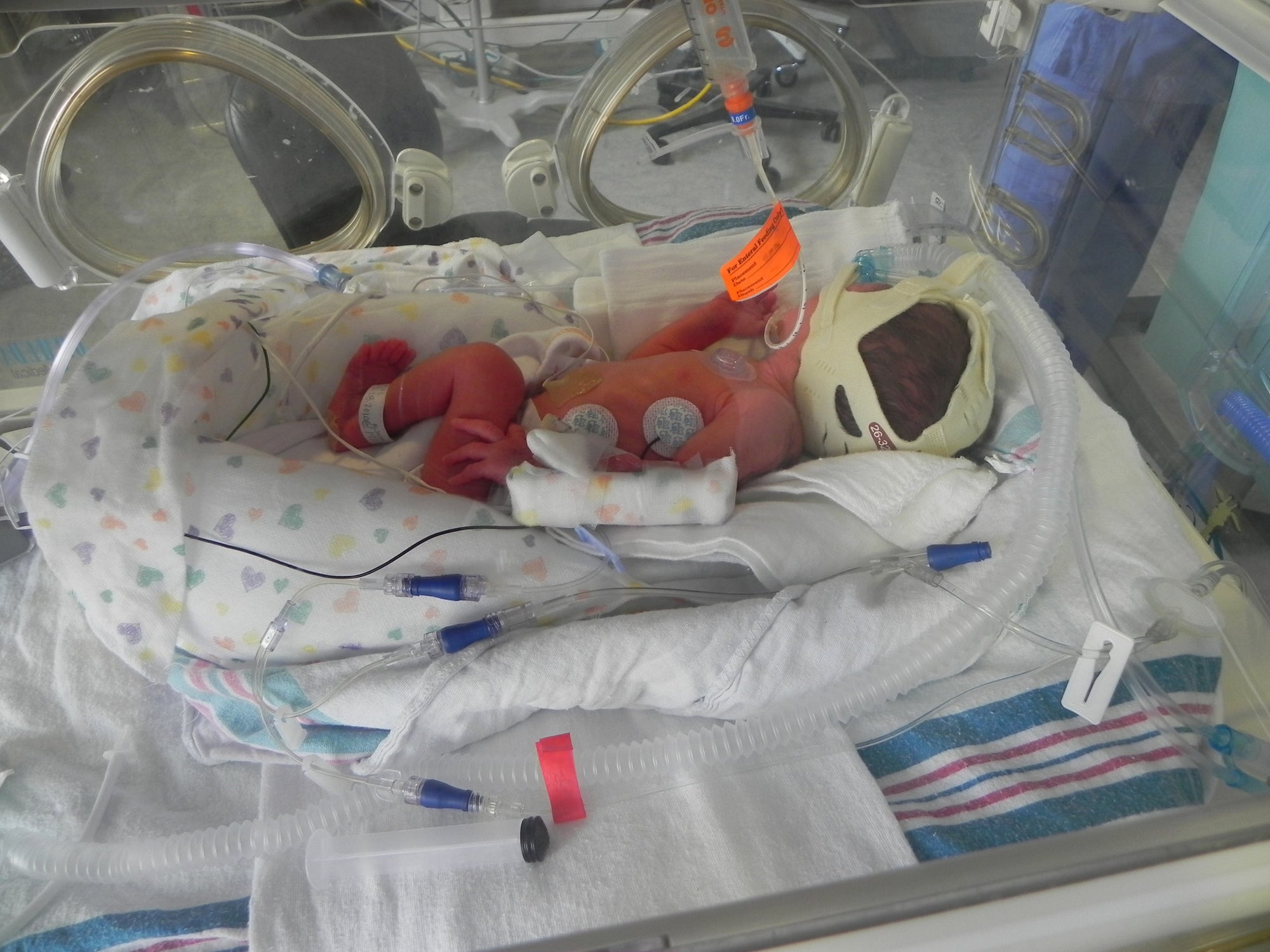 memeeno premie baby in an incubator